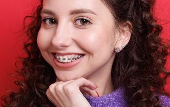 orthodontics traditional braces